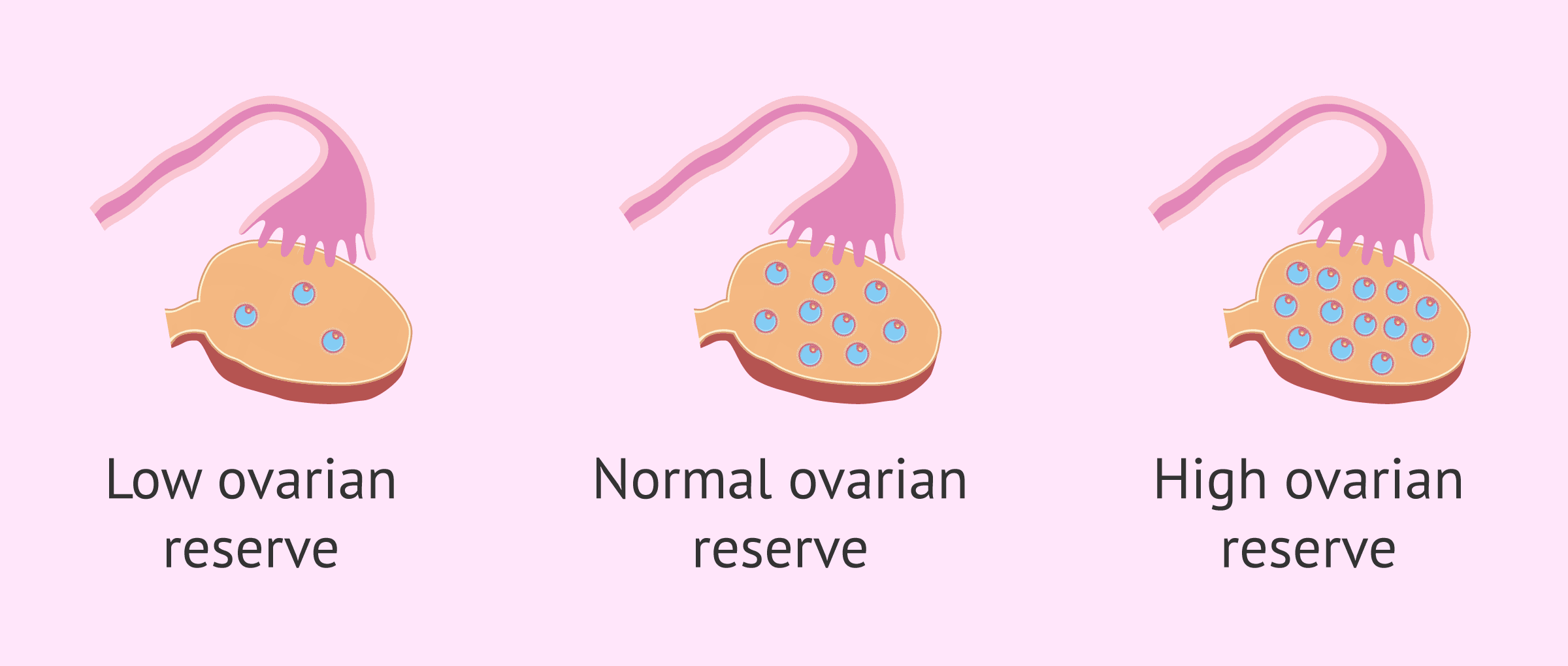 Ovarian Reserve